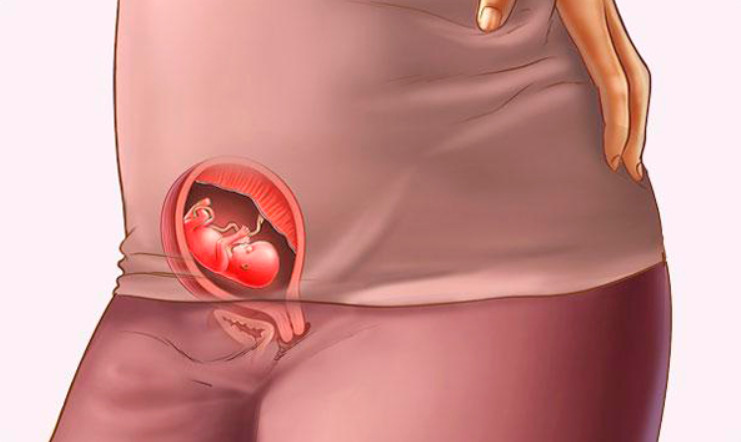11 haftalik gebelikte annedeki degisiklikler