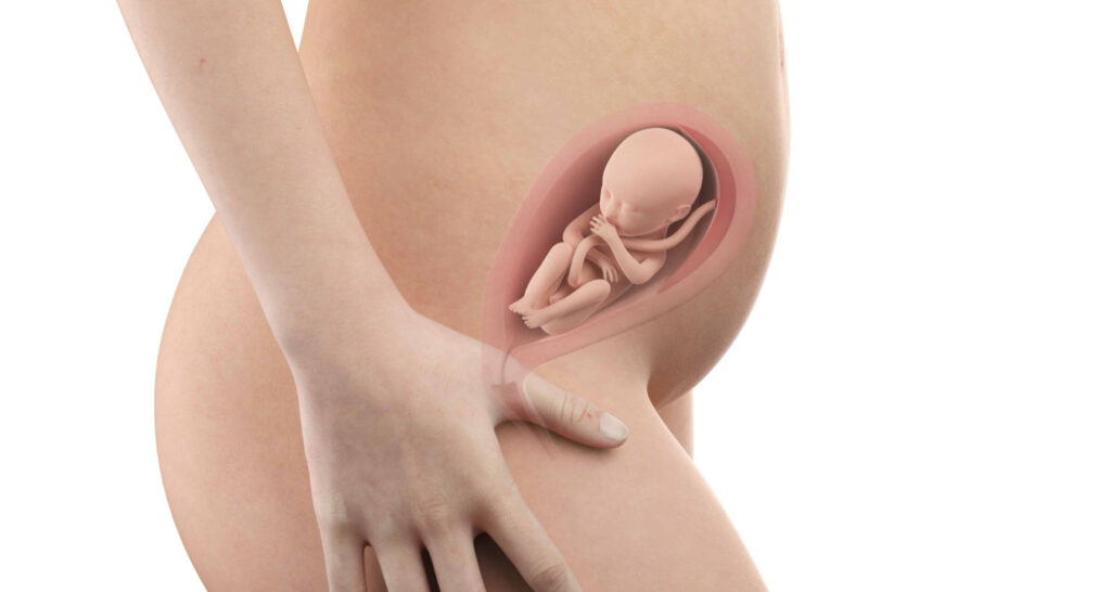 23 haftalik gebelikte anne karni